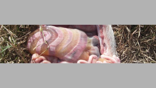 Edema de mesocolon producida por infección con E. 1