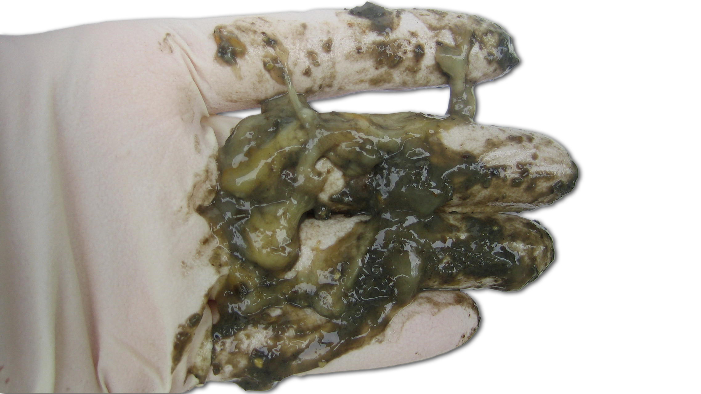 Diarreia catarral
