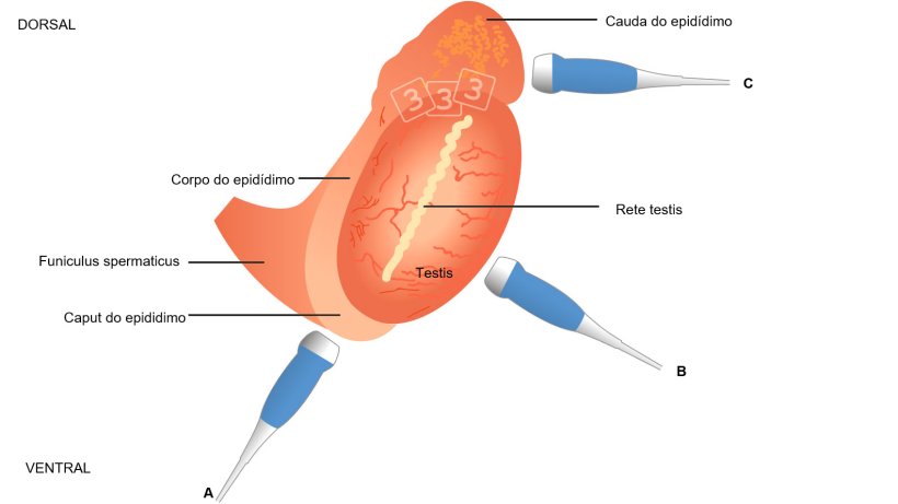 Fig. 4: &nbsp;Imagem esquem&aacute;tica da topografia do test&iacute;culo e do epid&iacute;dimo no varrasco, com coloca&ccedil;&atilde;o sugerida do transductor ao avaliar o caput epidimydis (= cabeza, a), corpo (b) e cauda (= cauda; A cabe&ccedil;a e a cauda v&ecirc;-se melhor com imagens longitudinais e transversais para o corpo ( Kauffold et al., 2011).

&nbsp;

&nbsp;
