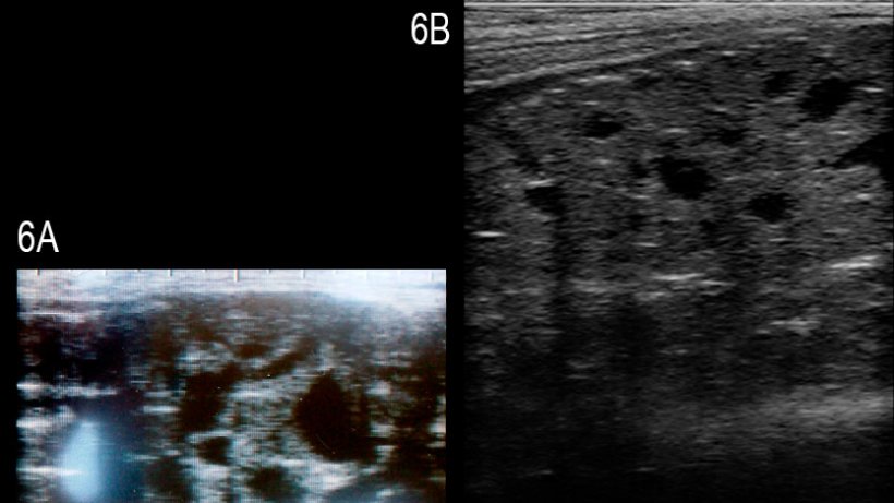 Figura 6: Imagens da gl&acirc;ndula bulbouretral do varrasco afectado com m&uacute;ltiplos quistos anecog&eacute;nicos bem definidos de diferentes tamamhos (A) e de um varrasco s&atilde;o (B (Grahofer et al., 2016).
