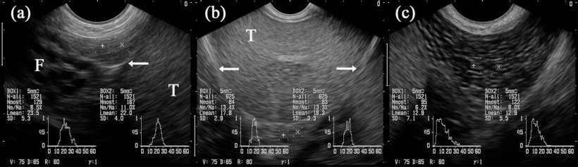 Figura 5:&nbsp;Imagens ultrasonogr&aacute;ficas dos segmentos do epid&iacute;dimo: caput (= cabeza, a), corpo (b) e cauda (= cauda; c). As caixas marcadas com "+" e "x" projectam-se nos respectivos segmentos do epid&iacute;dimo. Test&iacute;culo (T). Junto &agrave; cabe&ccedil;a h&aacute; estruturas tubulares m&uacute;ltiplas identificadas como partes do funiculus spermaticus (F). As setas indicam a cobertura testicular serosa (ou seja, bursa testicularis). (Kauffold et al., 2011)
