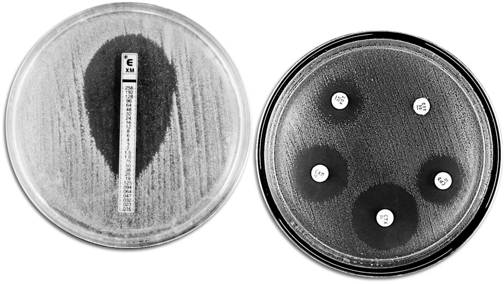 T&eacute;cnicas cl&aacute;ssicas de avalia&ccedil;&atilde;o da resist&ecirc;ncia a antibi&oacute;ticos. &Agrave; esquerda, E-TEST que permite medir a concentra&ccedil;&atilde;o&nbsp;m&iacute;nima de antibi&oacute;tico que impede o&nbsp;crescimento bacteriano. &Agrave; direita, um antibiograma em que s&atilde;o observados diferentes aur&eacute;olas de inibi&ccedil;&atilde;o do crescimento por parte dos antibi&oacute;ticos.
