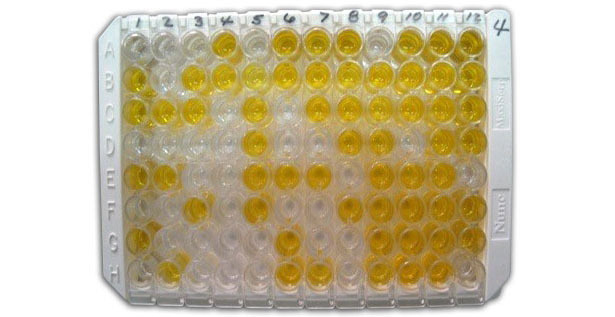 Figura 1: ELISA indirecto para a detecção de anticorpos anti-clamidia no soro.
