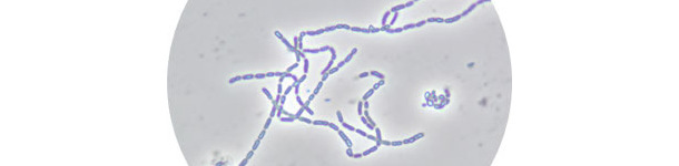 Figura 2. Lactobacillus rhamnosus CTC1679 al microscopio &oacute;ptico de contraste de fases
