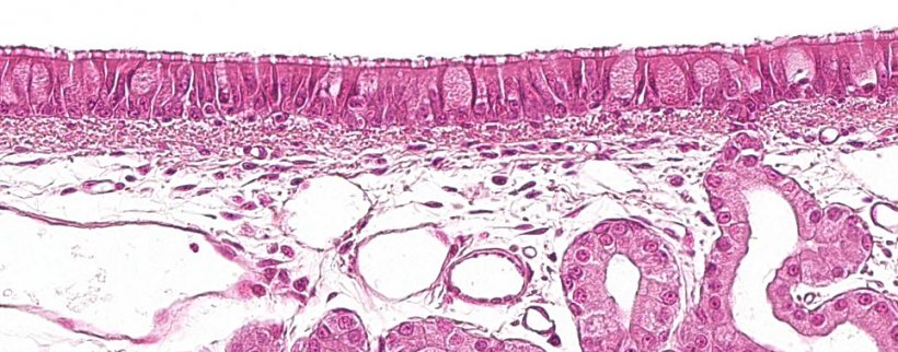 Figura 1: Epitélio pseudo-estratificado ciliado com células caliciformes característico do aparelho respiratório
