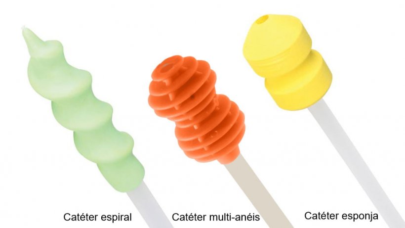 Foto 2. Existem diferentes tipos de cat&eacute;ter no mercado. O protocolo de coloca&ccedil;&atilde;o no c&eacute;rvix &eacute; distinto segundo o cat&eacute;ter usado. &Eacute; importante adaptar-se ao cat&eacute;ter.
