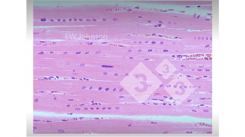 Figura 3. Músculo cardíaco com hemorragia, necrose hialina e alinhamento dos núcleos mostrando deficiência de vitamina E e selénio. Estes porcos não teriam um sistema imunitário que funcionasse normalmente.