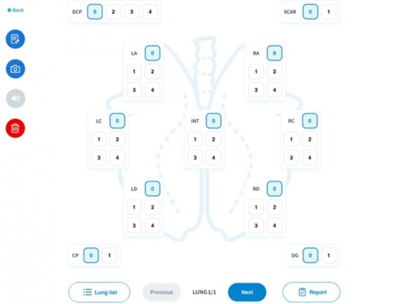 Figura 2. Software digital utilizado para a avaliação. As partes dos pulmões avaliadas numa escala de pontos incluíam o l&oacute;bulo apical esquerdo, o plexo cardíaco esquerdo, o plexo diafragmático esquerdo, o plexo intermédio, o plexo diafragmático direito, o plexo diafragmático direito, o plexo direito, o plexo cardíaco direito, o plexo apical direito, bem como as zonas afectadas por pleurisia craniana, pleurisia dorso-caudal e pleurisia apical direita; plexo cardíaco direito, plexo apical direito, bem como as zonas afectadas por pleurite craniana, pleurite dorso-caudal e presença de cicatrizes.
