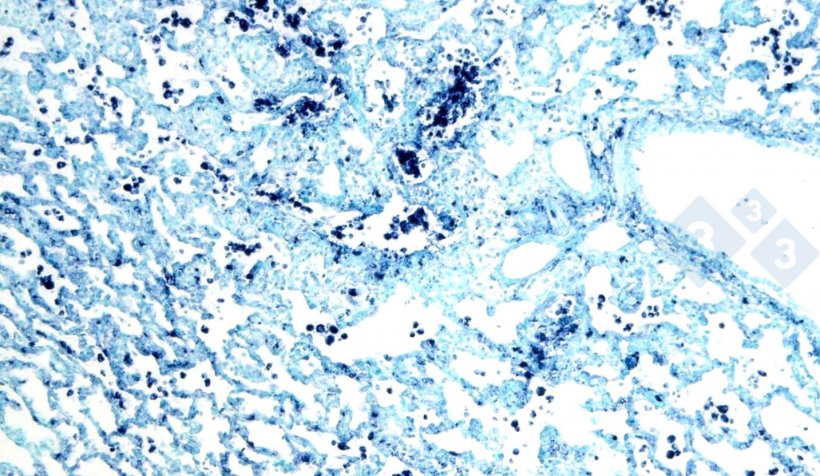 Figura 4. Hibridação  in situ para detectar circovirus suíno 2 (PCV2) num pulmão afectado de pneumonia intersticial.
