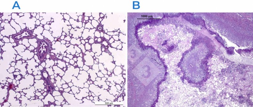 Figura 2. Coloração de hematoxilina-eosina de um pulmão normal (A) e afectado (B). O pulmão B é afectado por uma pleuropneumonite fibrino-necrotizante causada por Actinobacillus pleuropneumoniae.
