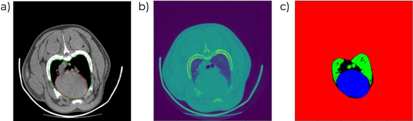 Figura 6. Imagens de TC onde o volume e o perfil card&iacute;acos s&atilde;o identificados (a, b) e os diferentes tipos de tecido s&atilde;o diferenciados automaticamente (c).