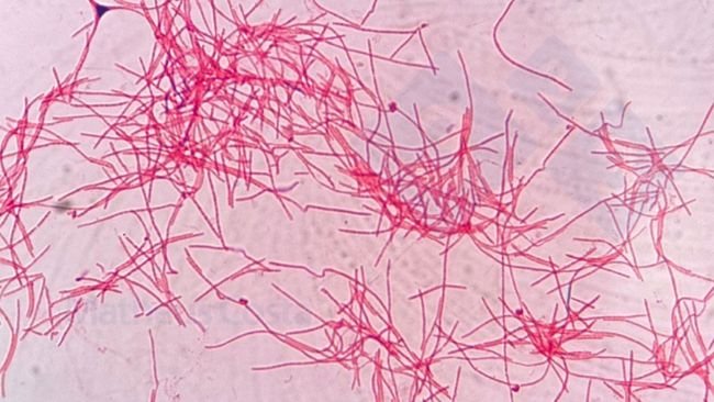 Figura 2. Fusobacterium necrophorum ao microscópio.