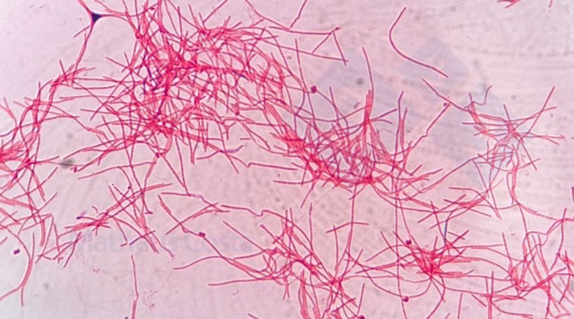 Figura 2. Fusobacterium necrophorum ao microscópio.