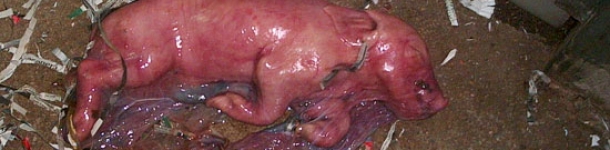 Monitorizaci&oacute;n de partos: Sistemas de control