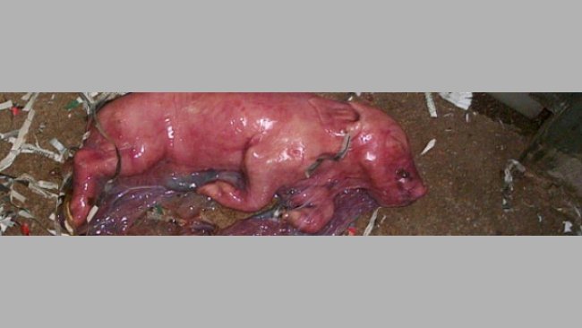 Monitorización de partos: Sistemas de control