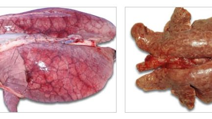 Pulmones