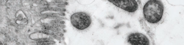 Bacteria ETEC