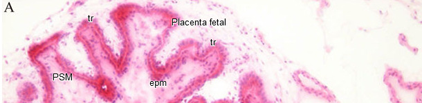 Histopatolog&iacute;a en endometrio y planceta
