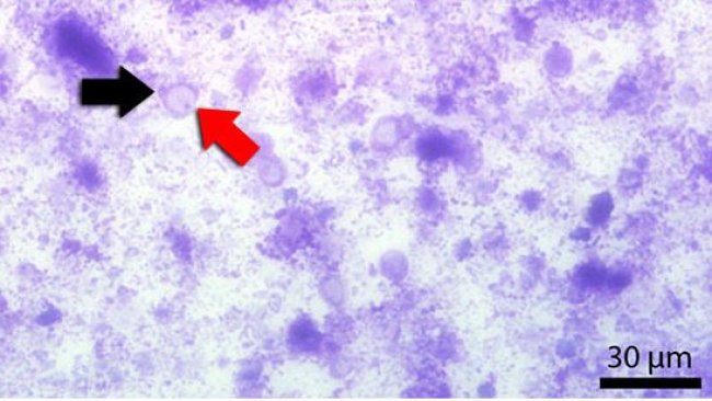 Frotis fecal teñido con Diff-Quick. La flecha roja señala la vacuola central y la negra el núcleo.