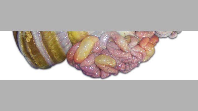 Factores de riesgo asociados a la enfermedad de los edemas